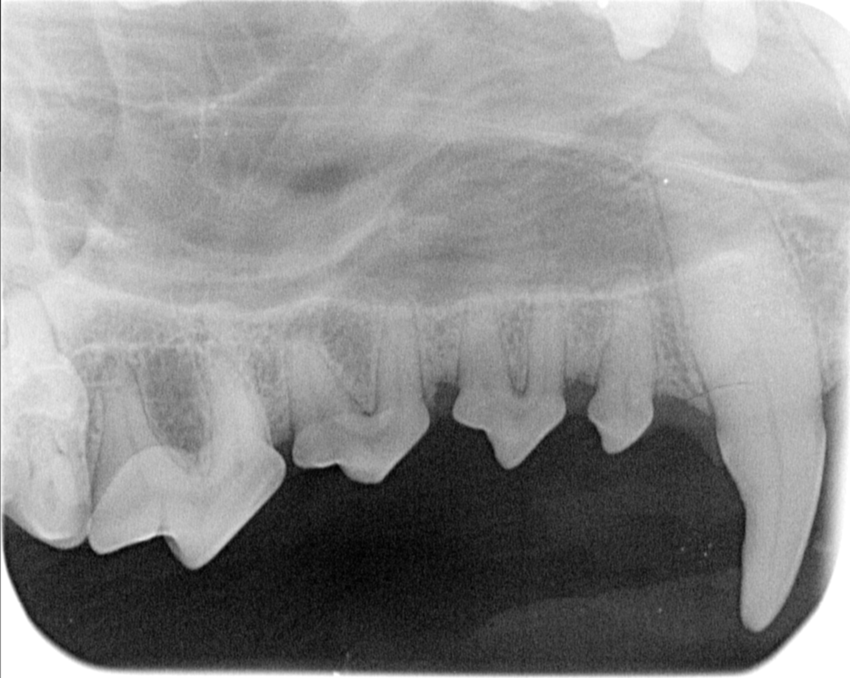 RX dentaal